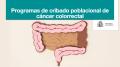 31/03/2023 - El Gobierno aporta 7,5 millones de euros a las comunidades y ciudades autónomas para la implementación de los programas de cribado poblacional de cáncer colorrectal